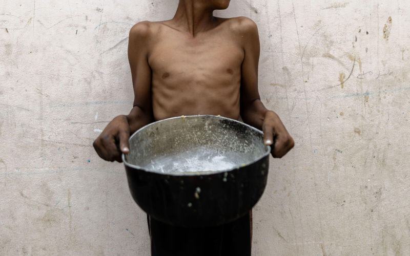Gaza, Gaza, Palestine. 18th May, 2025. A young boy visibly malnourished (Credit Image: (c) Saher Alghorra/ZUMA Press.Contributor: ZUMA Press, Inc. / Alamy Stock Photo Image ID: 3BHW555Wire) Gaza’s Hunger Games