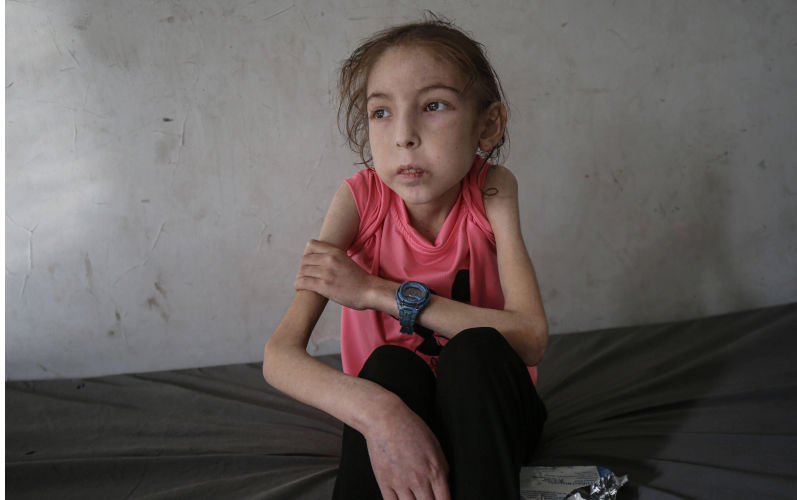 Rahaf-Ayyad, A displaced Palestinian child, Rahaf Ayad, 12 years old, is receiving care from her mother amid dire humanitarian conditions A displaced Palestinian child, Rahaf Ayad, 12 years old, is receiving care from her mother amid dire humanitarian conditions, in Gaza City, on 05 May 2025. Rahaf suffers from malnutrition and undiagnosed illnesses, and her health condition is described as critical. This comes amid a severe crisis caused by the lack of food and medicine due to the complete closure of border crossings and the comprehensive blockade imposed by the Israeli army on the Gaza Strip. Contributor: Imago / Alamy Stock Photo Image ID: 3B74M28 'This isn't me': Israeli war and healthcare collapse leave Gaza child unrecognisable