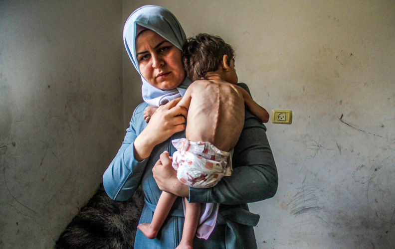 Middle East news.War Gaza.Return of hunger to northern Gaza Strip Three-year-old Palestinian child Amjad Al-Qanou, whose health is deteriorating due to malnutrition, struggles to survive in northern Gaza. Palestinian children in the Gaza Strip face an increased risk of death due to malnutrition and dehydration amid Israeli attacks. The Gaza Strip Palestine Copyright: xMahmoudxIssax IMG_04 Contributor: Imago / Alamy Stock Photo Image ID: 2YBYJTE 'Genocide in action' as 60-day blockade plunges Gaza into mass starvation
