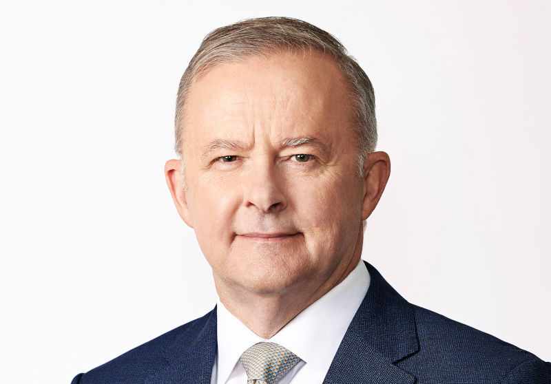 Anthony Albanese