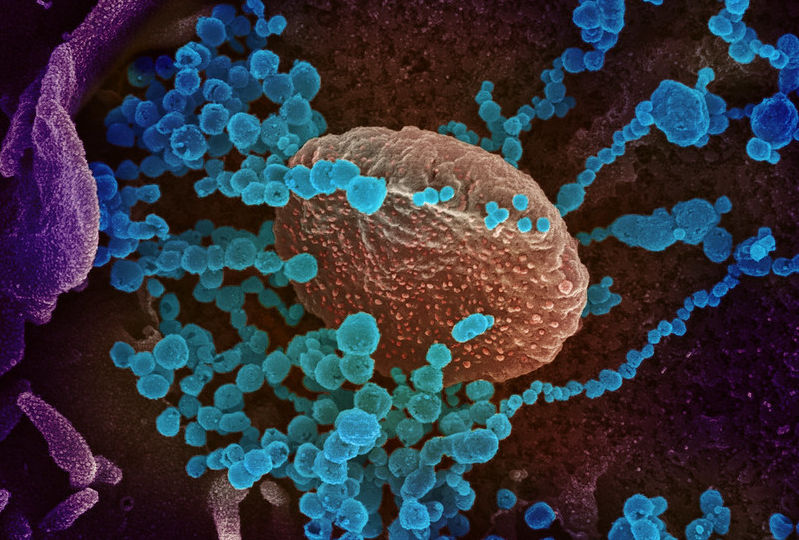 Coronavirus SARS-CoV-2 microscope view