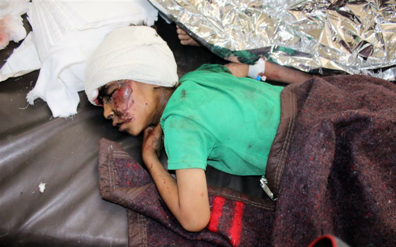 Bus Bombing. A wounded Yemeni child lies on a bed receiving treatment at a hospital after being injured during the air strike